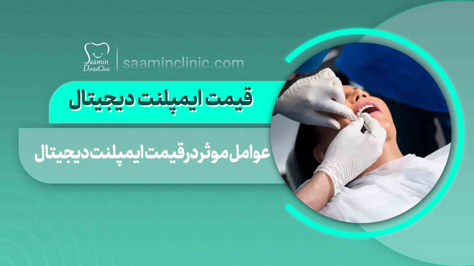 ایپلنت دیجیتال