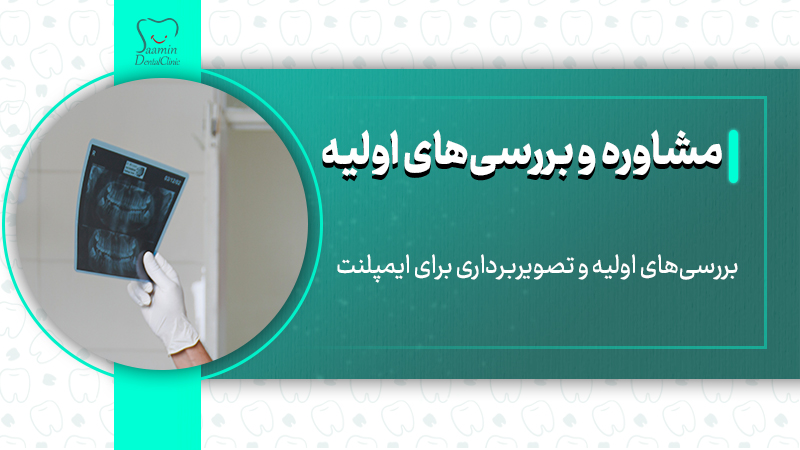 تصویری از مرحله اول مشاوره و بررسی های اولیه قبل از ایمپلنت در مرکز دندانپزشکی سامین