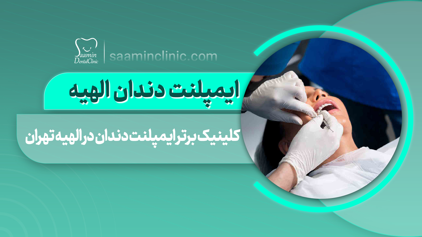 کلینیک برتر ایمپلنت دندان در الهیه تهران