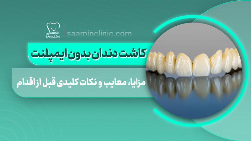 تصویر کاور مقاله کاشت دندان بدون ایمپلنت