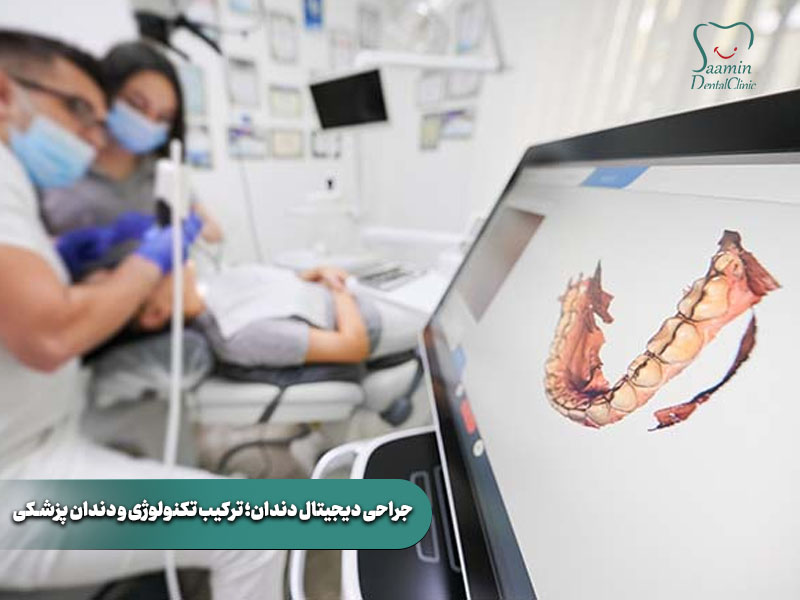 یک تصویر مقایسهای واضح و گرافیکی که تفاوت ایمپلنت را با روشهای سنتی نشان میدهد.