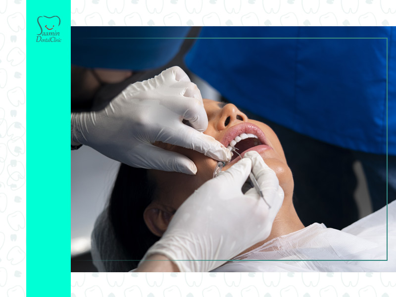 تصویری از معاینه دندان های بیمار خانوم در کلینیک دندان پزشکی سامین