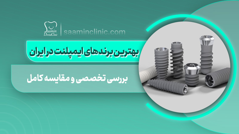 تصویری از کاور مقاله بهترین برندهای ایمپلنت در ابران