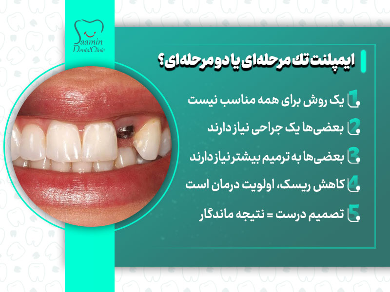 تصویری از توضیح ایمپلنت تک مرحله ای و دو مرحله ای