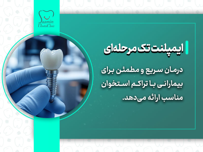 تصویری از یک دندان که نمونه ایمپلنت هست و ایمپلنت تک مرحله ای را نمایش میدهد