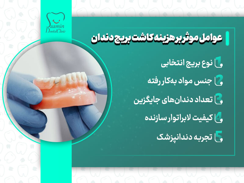 تصویری از عوامل موثر بر هزینه کاشت بریج دندان