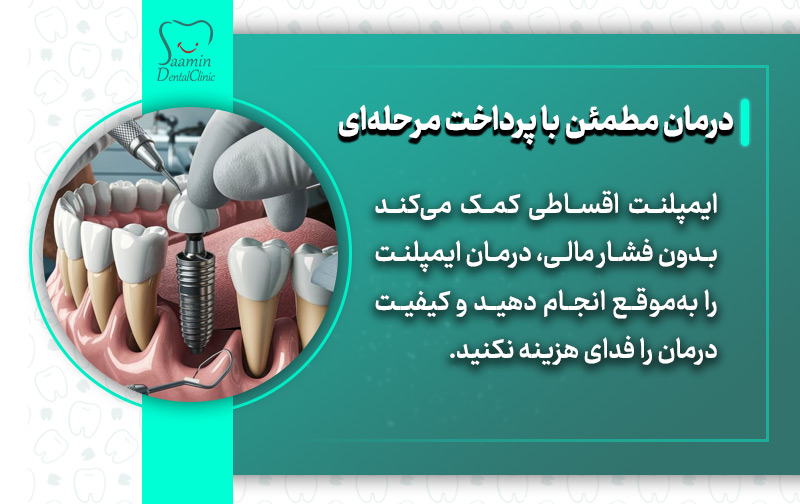 تصویر کامپیوتری از قالب ایمپلنت دندان و توضیح درمان مطمئن با پرداخت مرحله ای
شرایط اقساط ایمپلنت دندان
