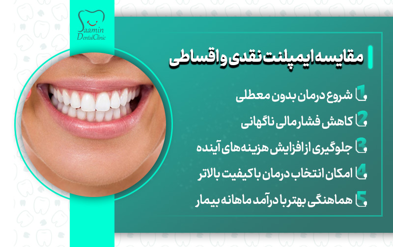 تصویری از دندان های ایمپلنت شده خانوم و توضیح مقایسه ایمپلنت نقدی و اقساطی