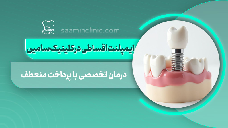 تصویری از کاور مقاله ایمپلنت اقساطی در کلینیک سامین
