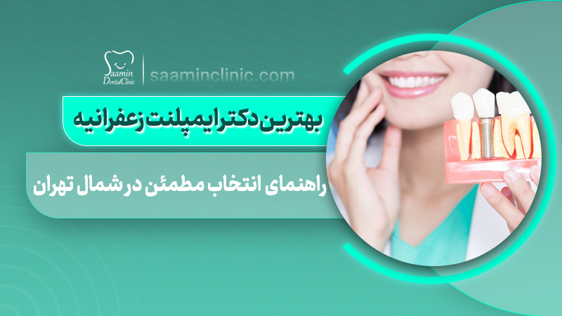 تصویری از کاور مقاله بهترین دکتر ایمپلنت زعفرانیه