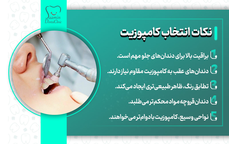 تصویری از مراحل کامپوزیت دندان و توضیح نکات انتخاب کامپوزیت