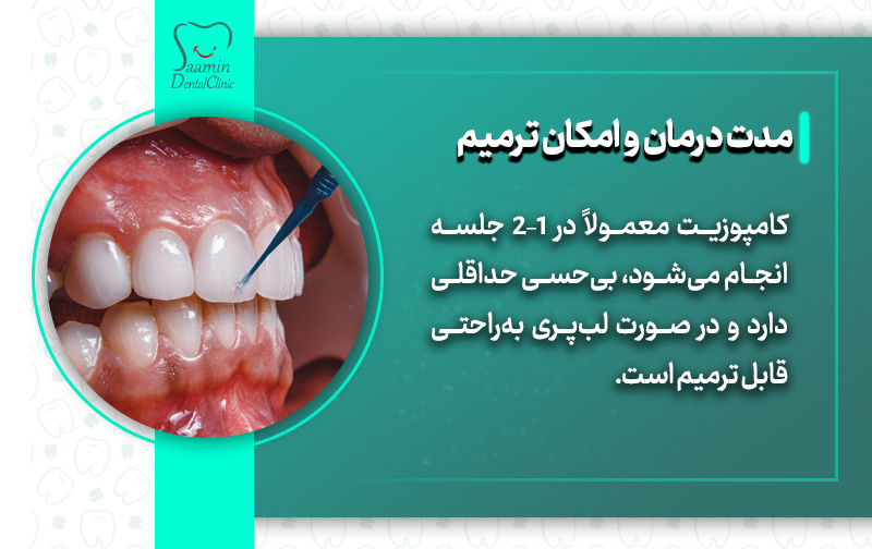 تصویری از مراحل کامپوزیت دندان و توضیح مدت درمان و امکان ترمیم