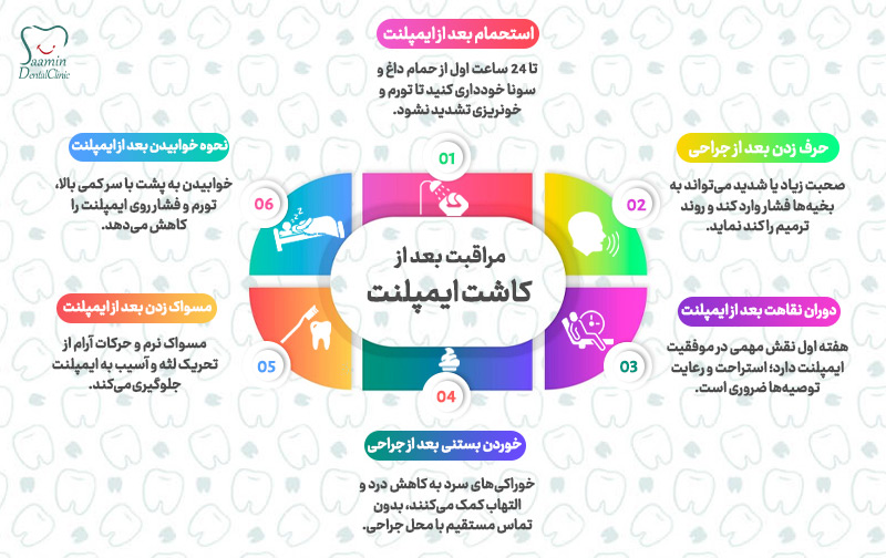 تصویری از توضیح جدول مراقبت بعد از کاشت ایمپلنت
