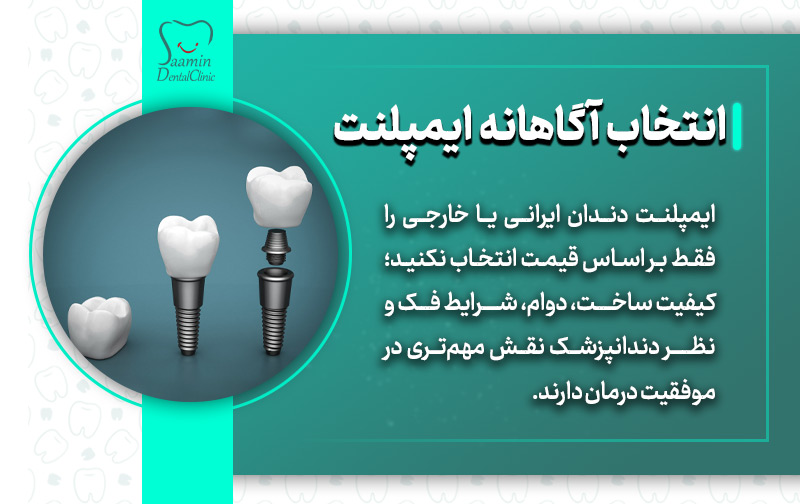 تصویری از قالب ایمپلنت و توضیح انتخاب آگاهانه ایمپلنت