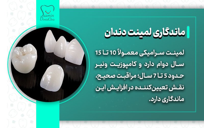 تصویری از قالب لمینت دندان و توضیح ماندگاری لمینت دندان