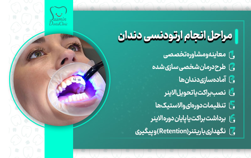 تصویری از نصب ارتودنسی بر روی دندان بیمار خانوم و توضیح مراحل انجام ارتودنسی دندان