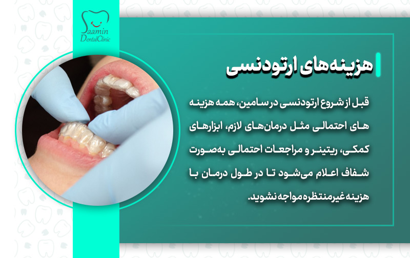 تصویری از نصب ارتودنسی و توضیح هزینه های ارتودنسی