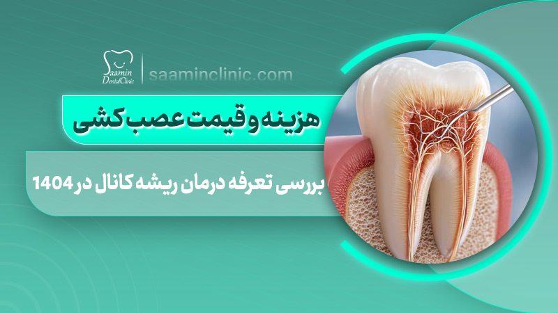 تصویری از کاور مقاله هزینه و قیمت عصب کشی در 1404