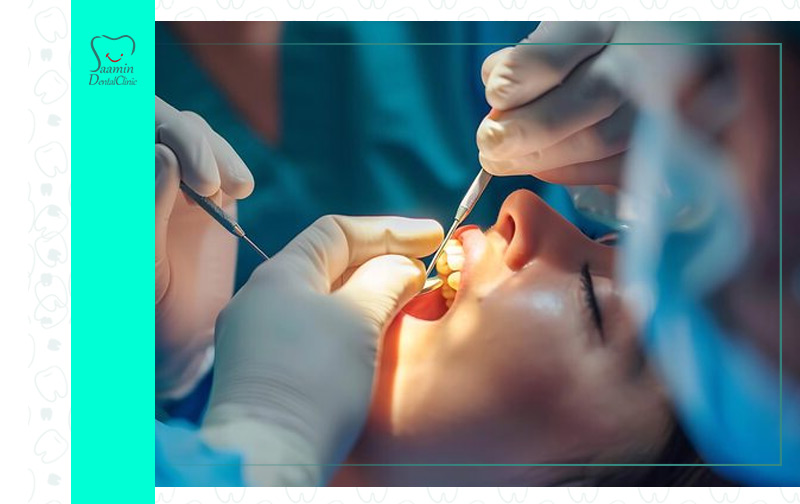 تصویری از بیمار خانوم در حال جراحی دندان در کلینیک دندان پزشکی سامین